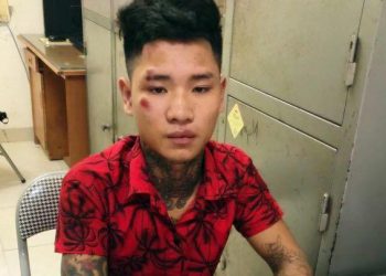 Tạm giữ hình sự đối tượng ngổ ngáo, đâm dập đùi trung úy cảnh sát