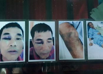 Phú Thọ: Nhóm đối tượng côn đồ mang hung khí xông vào nhà riêng đánh người