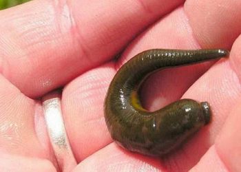 Kinh hoàng: Đỉa chui vào trong âm đạo bé gái 8 tuổi ở Phú Thọ