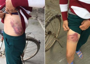 Phú Thọ: Cô ruột bị cháu trai đánh bầm dập trong ngày giỗ bố