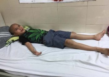 Con liên tiếp mổ não, cả nhà có nguy cơ “ra đường”