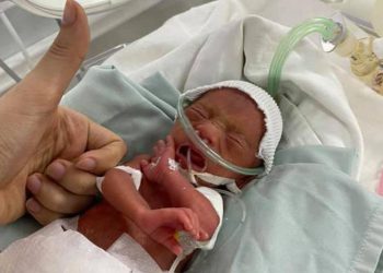 Phú Thọ: Kỳ diệu 76 ngày giành giật sự sống cho ca sinh non chỉ nặng 600gr