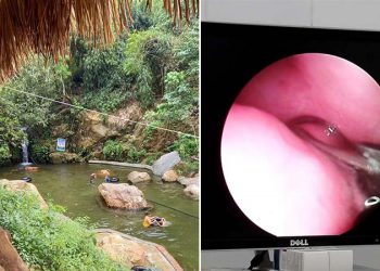 Nữ sinh đi tắm thác ở Phú Thọ, bị đỉa dài 3cm chui vào mũi