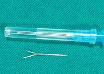 Tự lấy xương cá bị hóc không được, cụ ông phải nhập viện cấp cứu