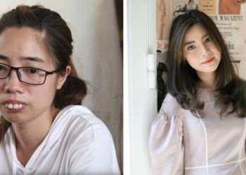 Thoát khỏi hình hài “Thị Nở” sau 30 năm, cô gái Phú Thọ hóa xinh ngoạn mục nhờ “bạo gan” phẫu thuật thẩm mỹ