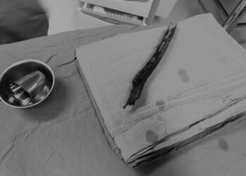 Phú Thọ: Lái xe khi say rượu, nam thanh niên bị cành cây đâm xuyên thấu vùng mũi, mặt