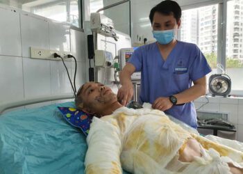 Phú Thọ: Chàng trai trẻ nguy kịch sau tai nạn thương tâm mất nửa phần da cơ thể