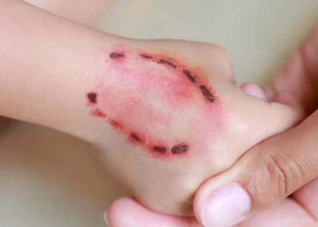 Phú Thọ: ‘Thú cưng’ nuôi trong nhà cắn 2 trẻ tử vong